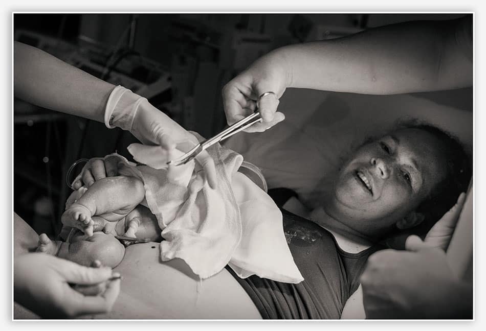 Doorknippen van de navelstreng